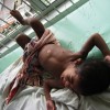 Child victims of the battle to end a bloody civil war