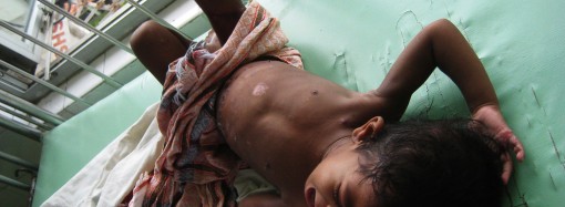Child victims of the battle to end a bloody civil war